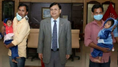 Photo of लखनऊ: KGMU के डॉक्टरों ने रचा इतिहास, सर्जरी कर जन्म से ही आपस में जुड़े राम और श्याम को किया अलग