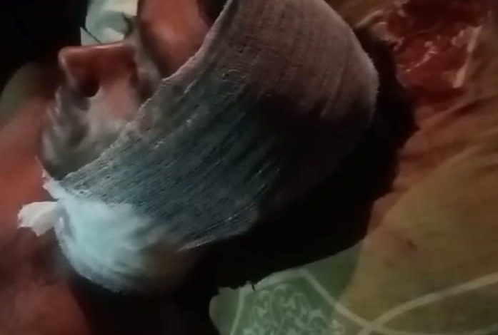 पानी विवाद के चलते चाकू से वार, एक घायल 3 IMG 20231006 WA0011