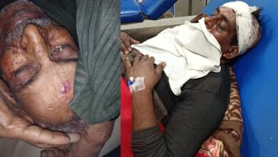 कानपुर देहात में दबंगों ने पिता पुत्र पर किया जानलेवा हमला, हालत गंभीर 4 Photo of कानपुर देहात में दबंगों ने पिता पुत्र पर किया जानलेवा हमला, हालत गंभीर