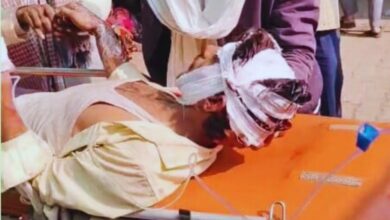 Photo of कानपुर देहात में बिजली विभाग की लापरवाही से लाइनमैन झुलसा,हालत गंभीर