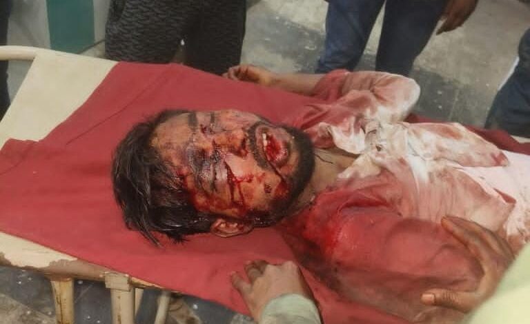 खेत में लहूलुहान मिला युवक: डेरापुर के खिरवां गांव में सनसनी, हत्या के प्रयास का मामला दर्ज 1 शिवा दिवाकर हमला मामला कानपुर देहात