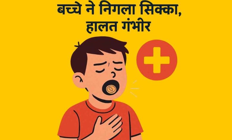 बच्चे ने खेलते समय निगला सिक्का