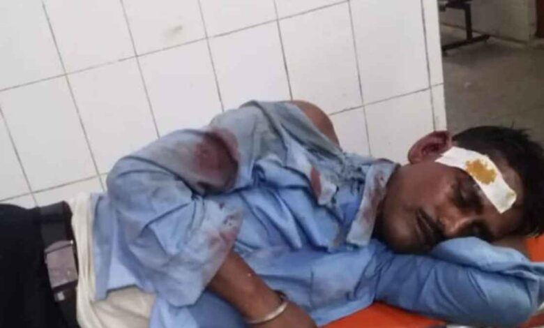 कानपुर देहात: राजपुर में सड़क हादसे में बाइक सवार गंभीर,भेजा गया जिला अस्पताल 1 कानपुर देहात राजपुर सड़क हादसा